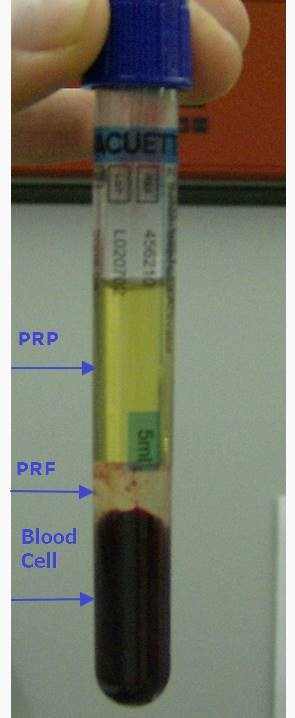 צנטריפוגות PRP/PRF צנטריפוגות PRP/PRF